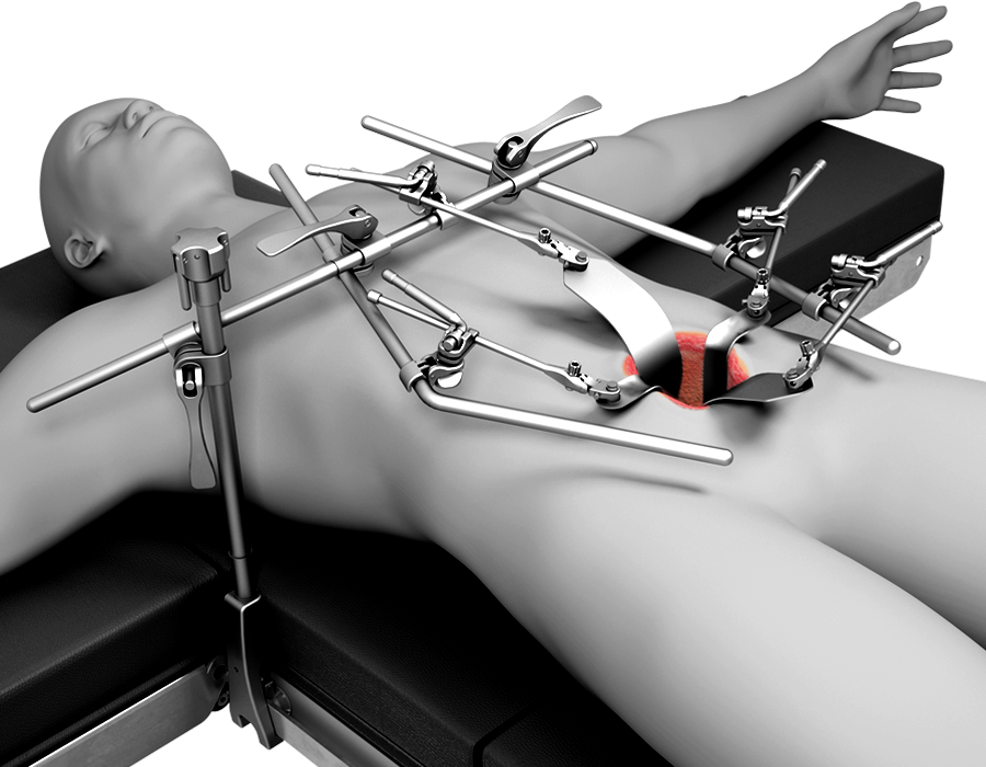 Surgical Retractor Set Cost
