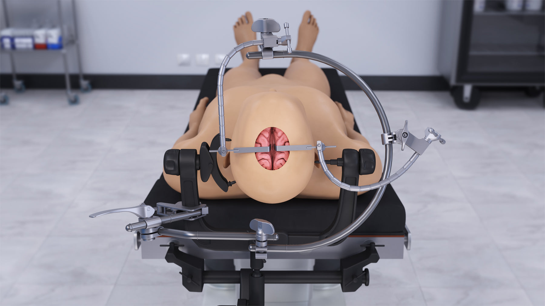 Brain skull clamp retractor