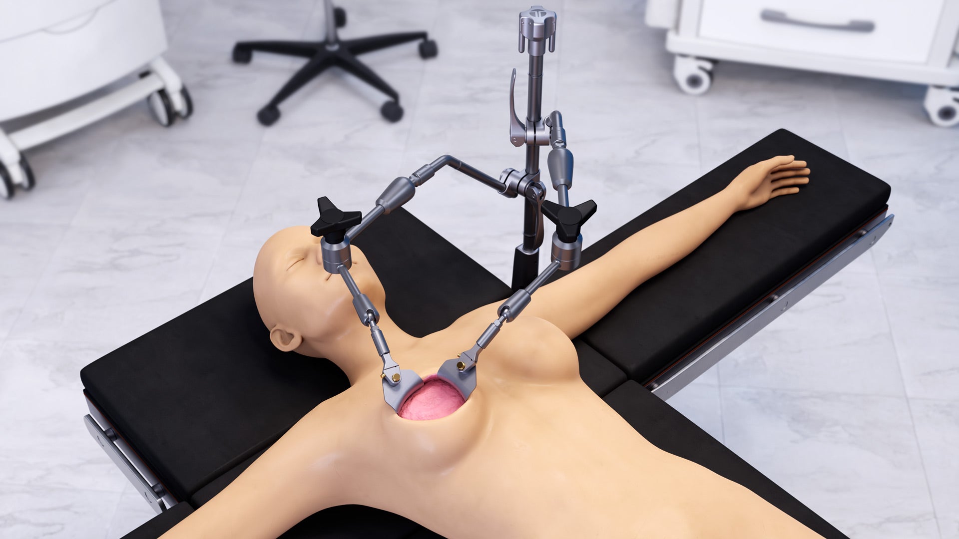 Mastectomy Articulating Arm Retractor Set