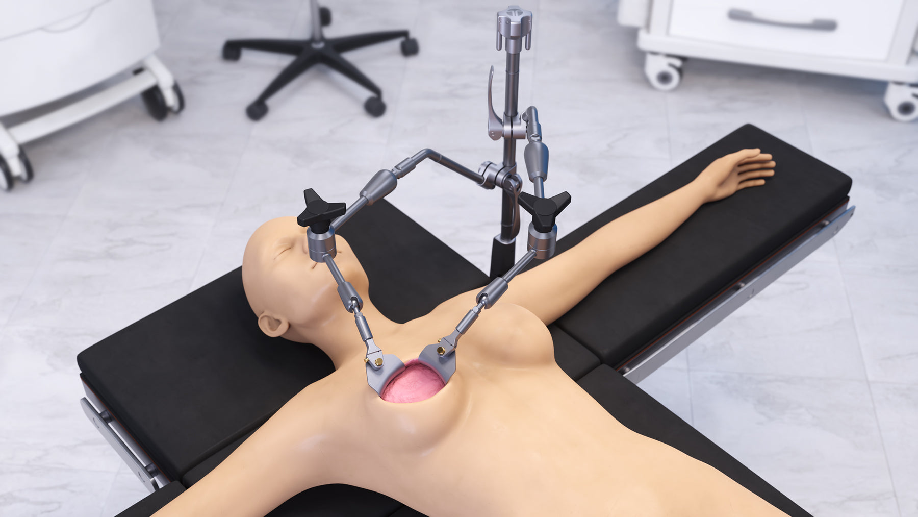 Breast Articulating Arm Retractor Set – Surgical Instrument