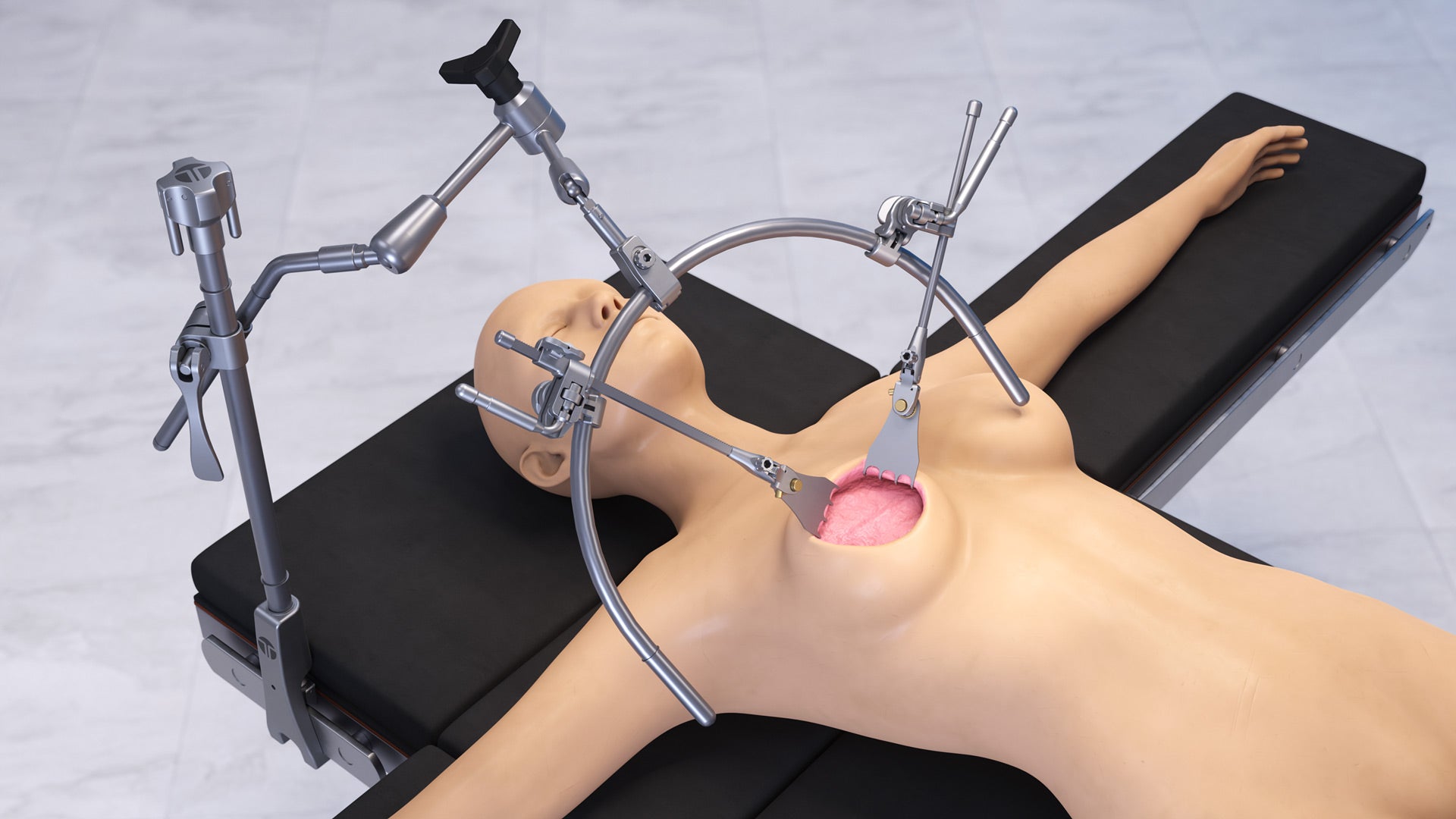 Mastectomy Breast C-Frame Retractor Set