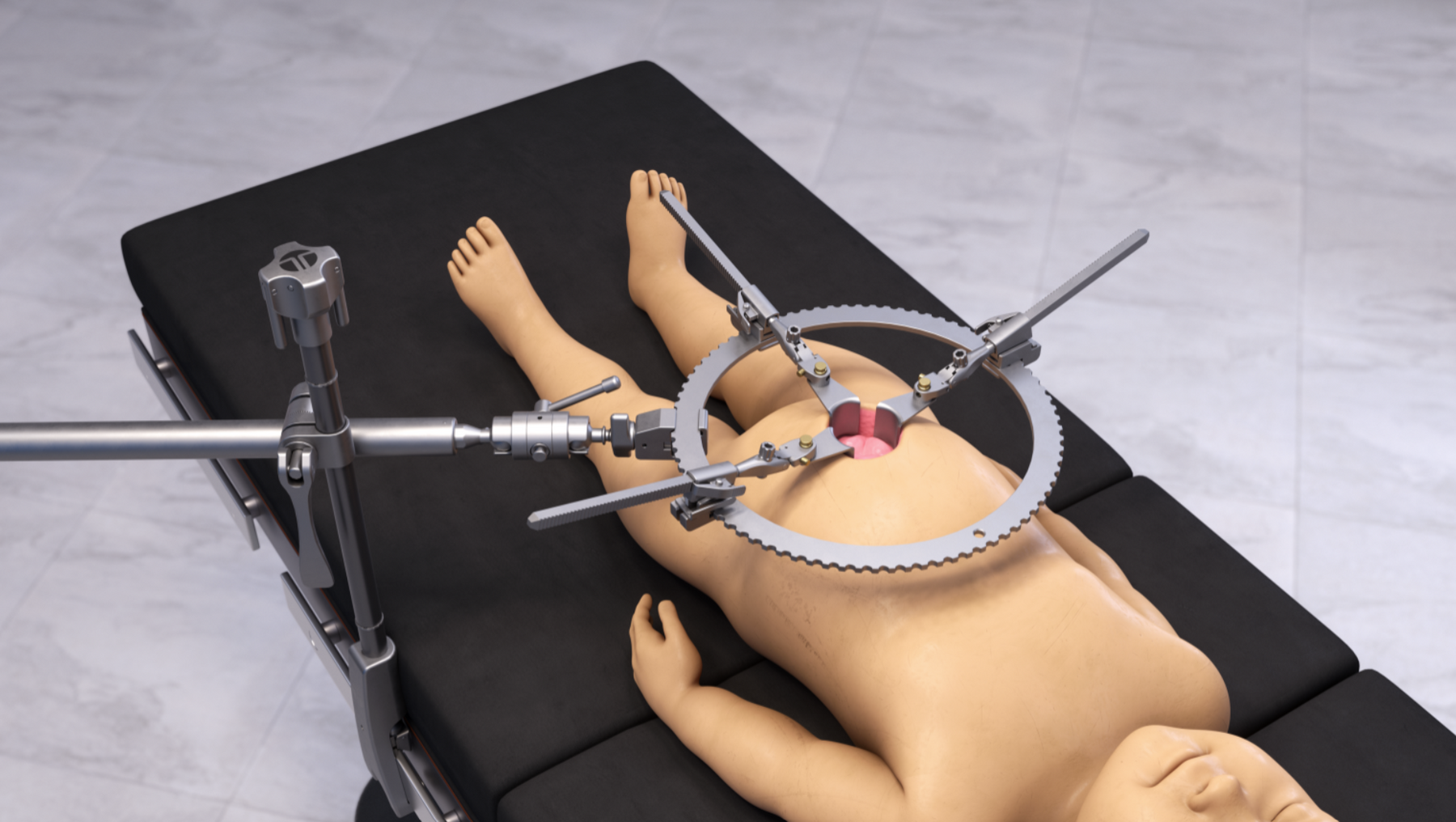 Pediatric ring retractor
