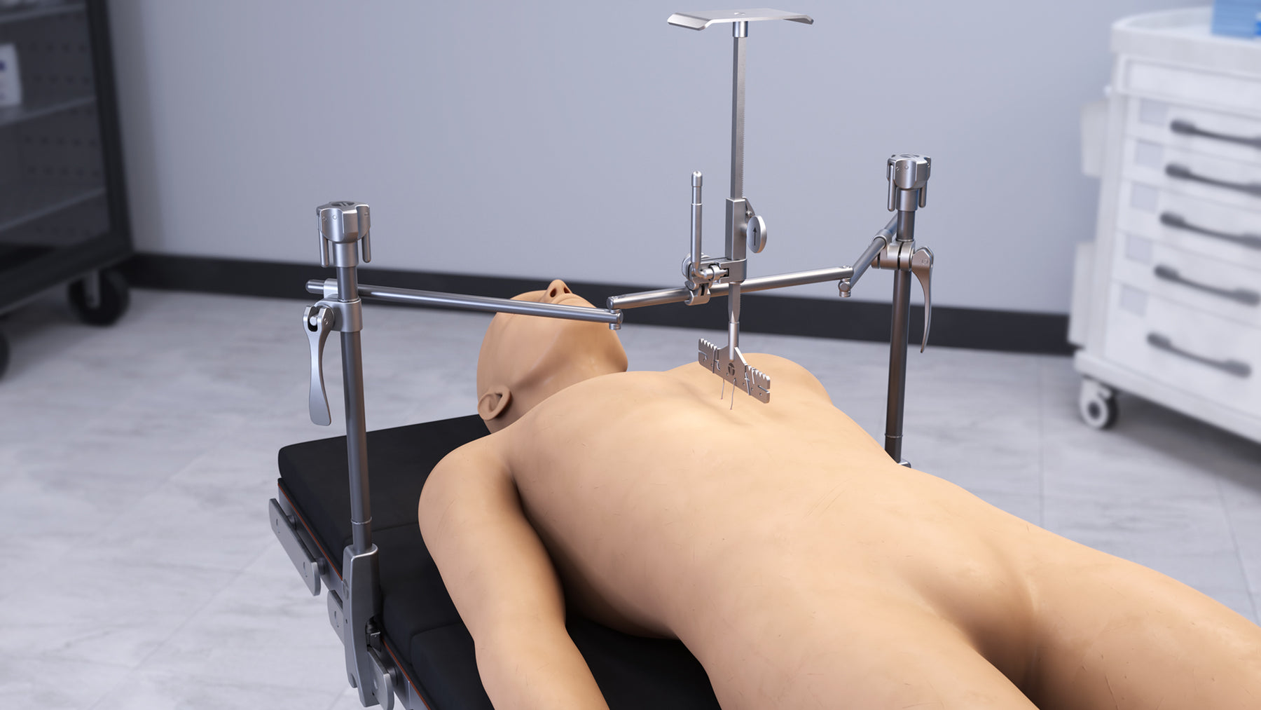 PectusAssist retractor