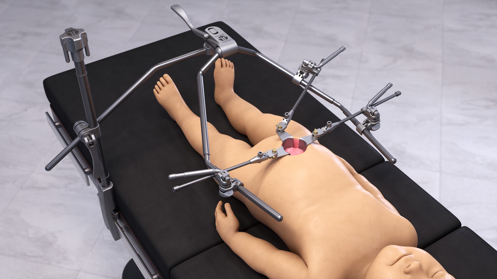 Pediatric Abdominal OneFrame Retractor Set