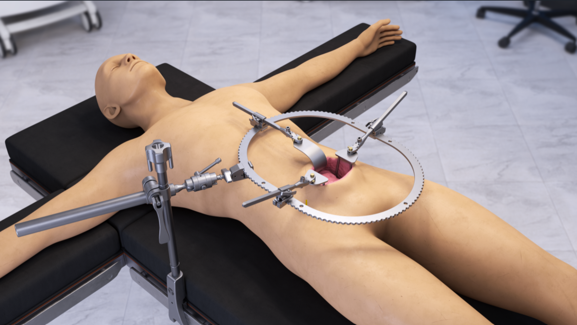 Thompson Surgical product image