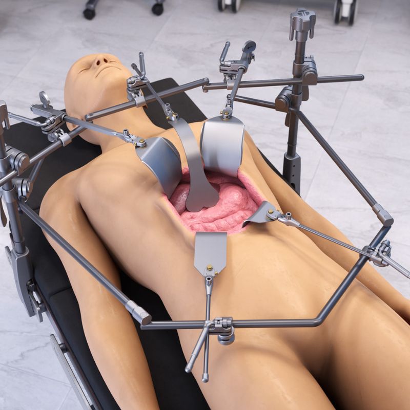 Retractor system for Liver, Biliary, and Pancreatic Procedures