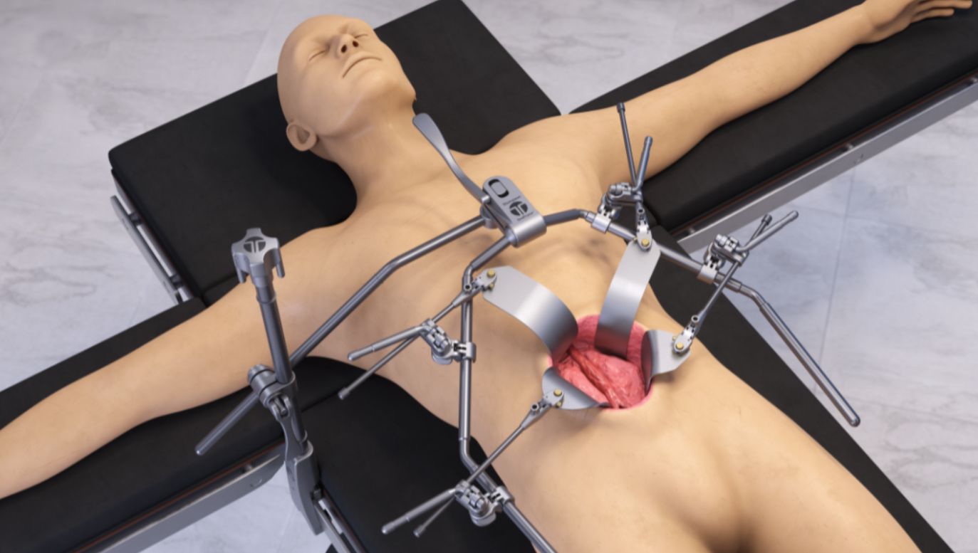 AAA OneFrame Retractor Set # SL82063