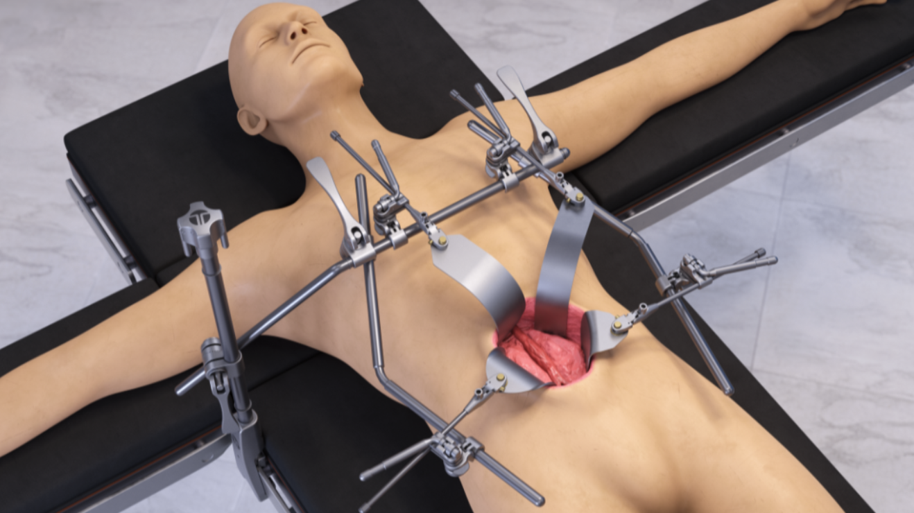 AAA Quick Frame Retractor Set # SL82003