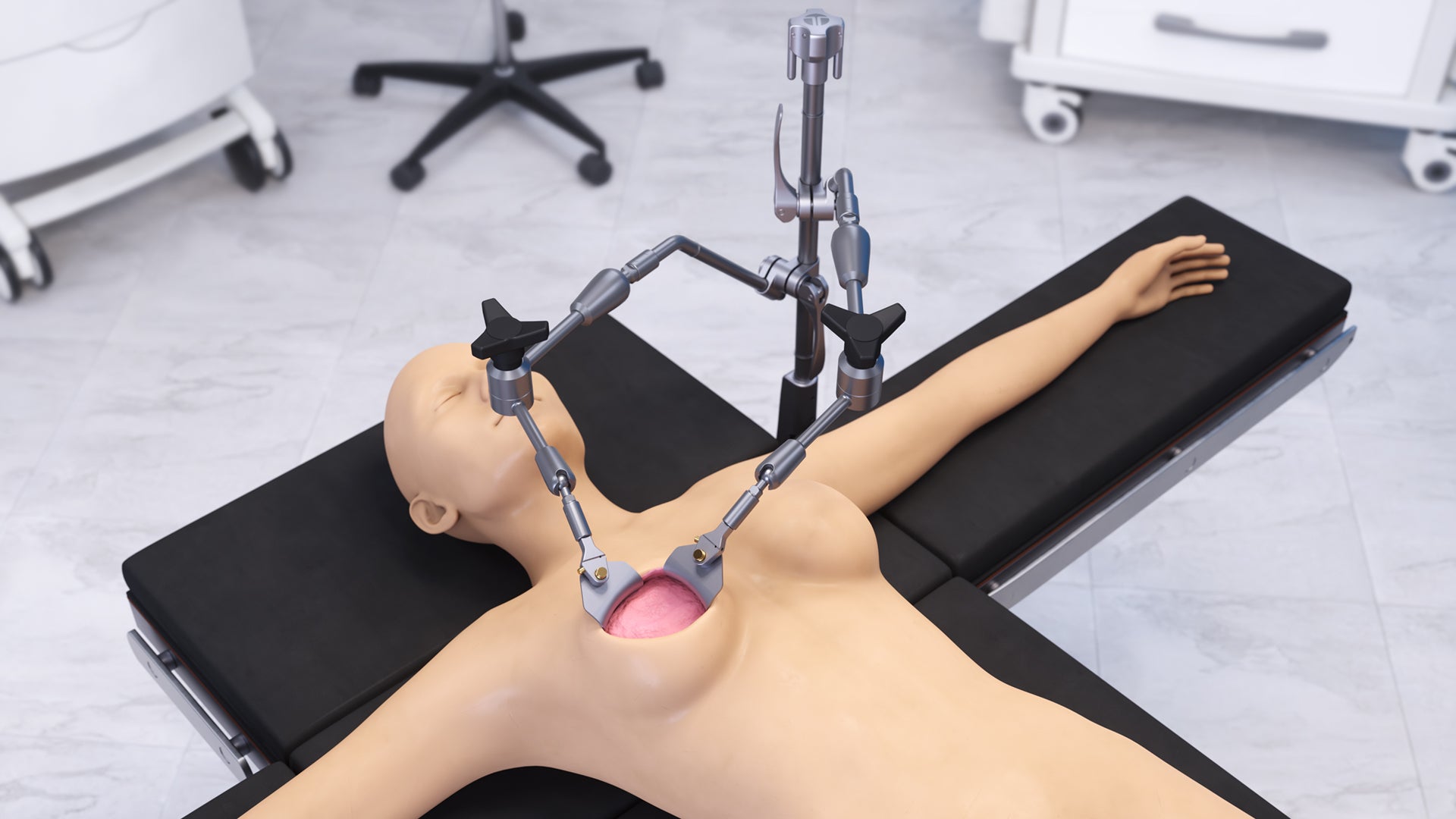 Mastectomy Articulating Arm Retractor Set # SL82041