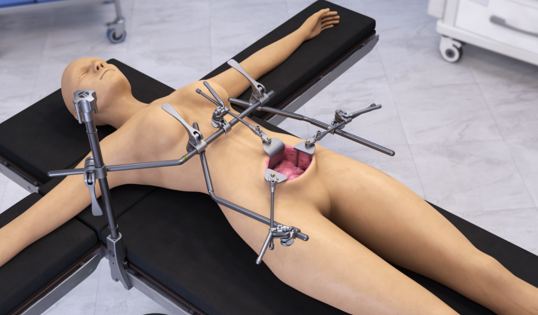 Gynecology Procedures