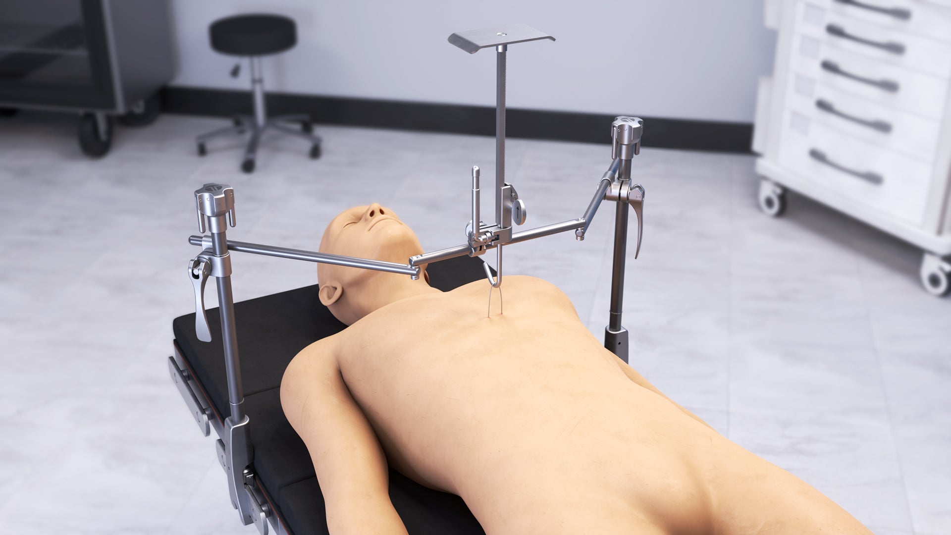 Pectus Elevator Retractor Set # 82051