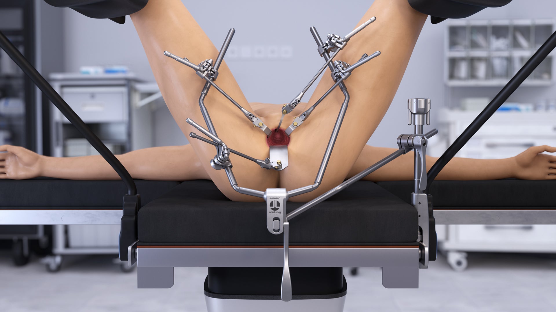 Urology OneFrame Retractor Set # SL82063