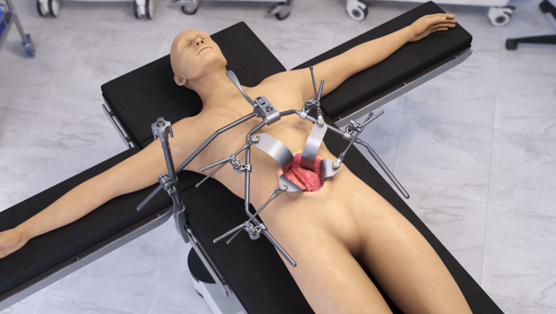 Thompson Surgical product image