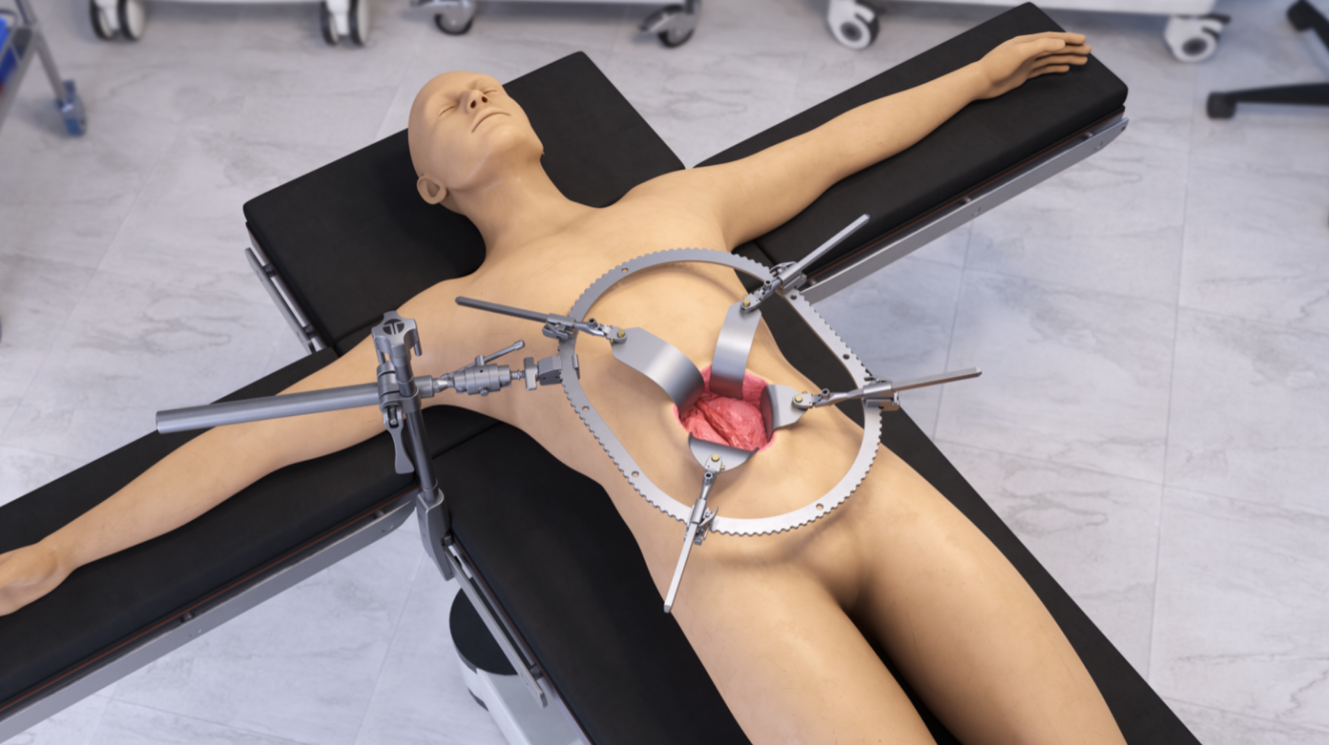 Thompson Surgical product image