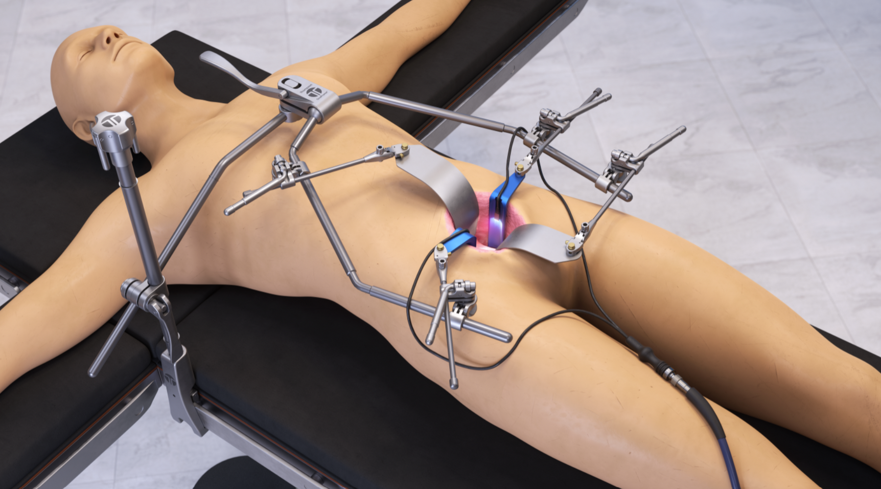 Lumbar retractor set