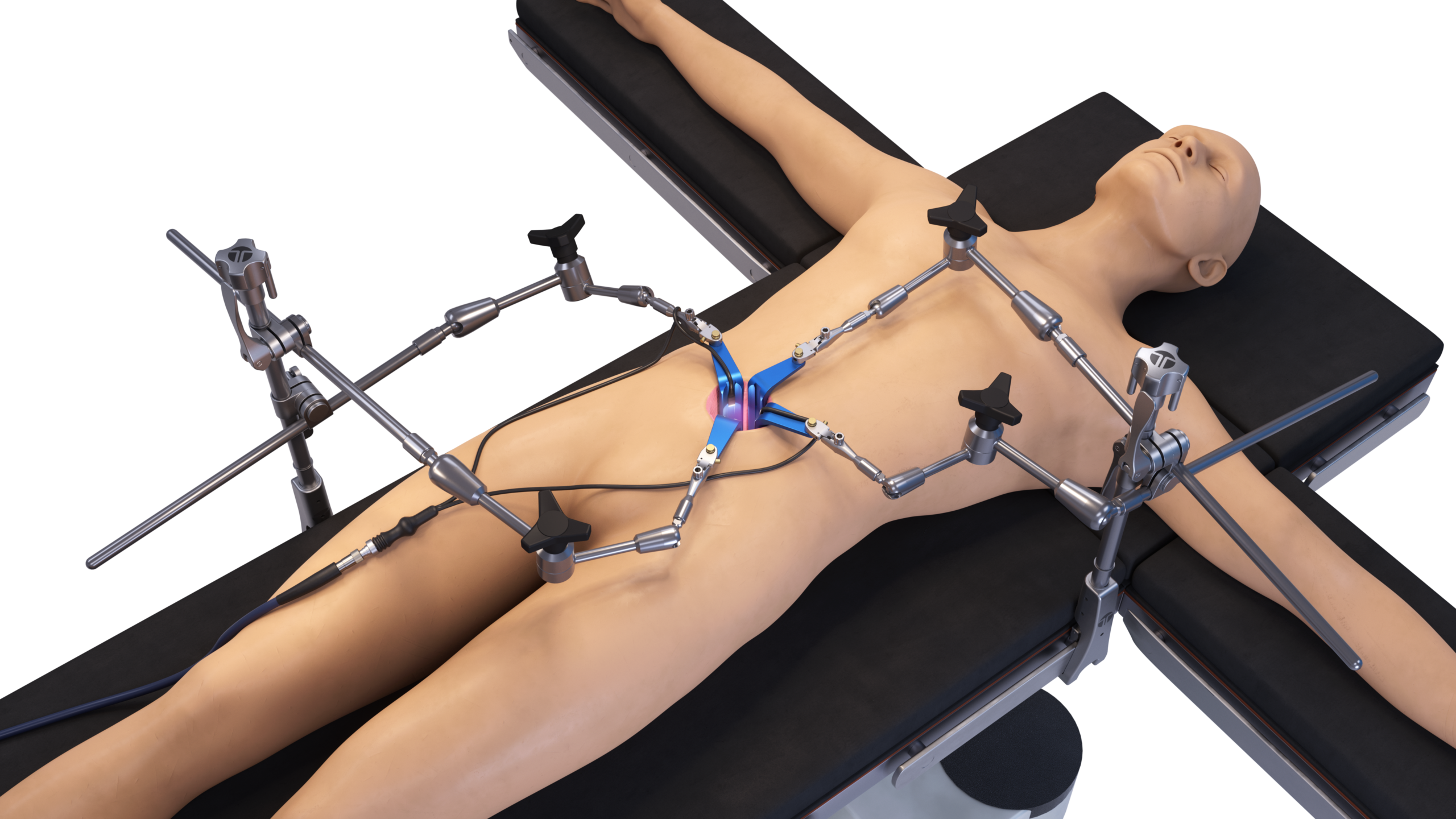 Articulating Arm Frame Kit