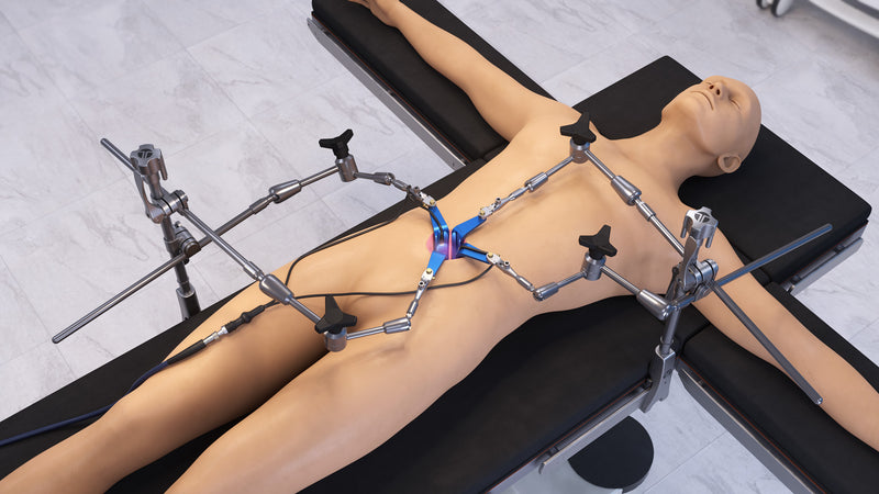 Anterior Articulating Arm Retractor Set