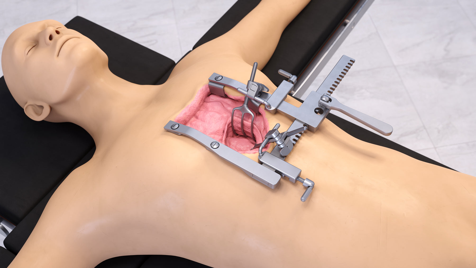 Mitral valve retractor set