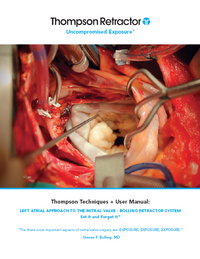 Technique: Bolling Retractor User Manual