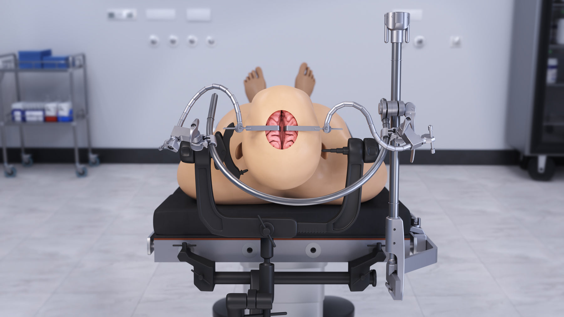 Brain retractor system