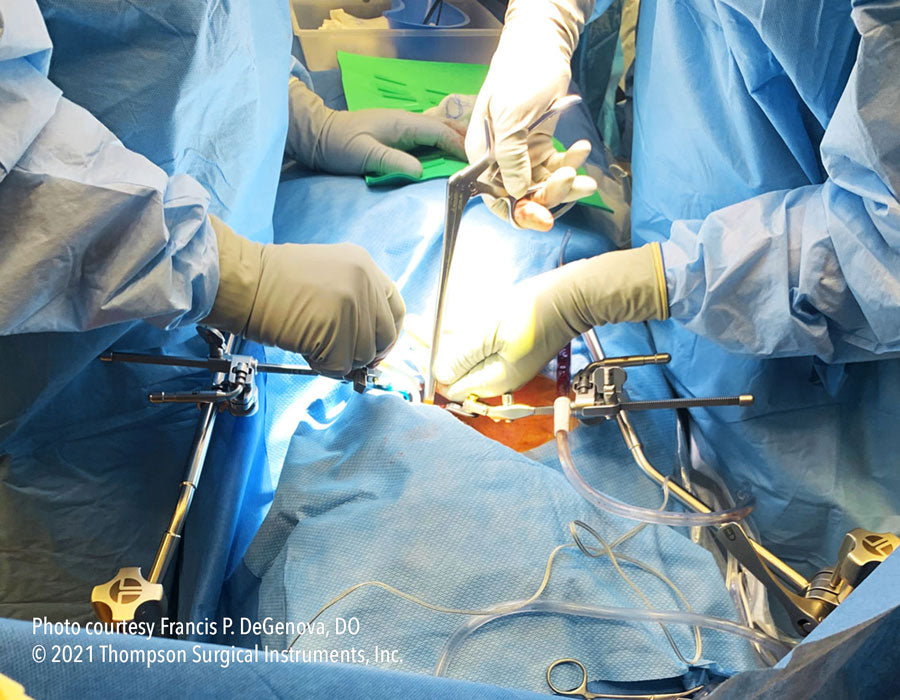 Cervical Retractor Set | Spine: Cervical | Thompson Retractor ...