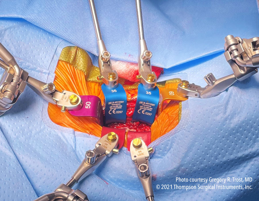 Modified Thompson Retractor Cervical Retractor Set | Spine: Cervical | Thompson Retractor ...