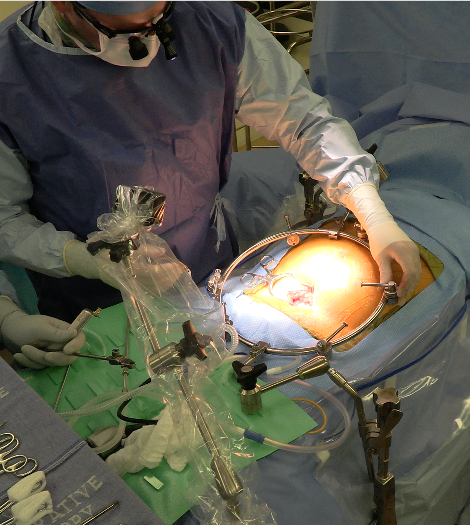 Clinical image AL Ring 3 #