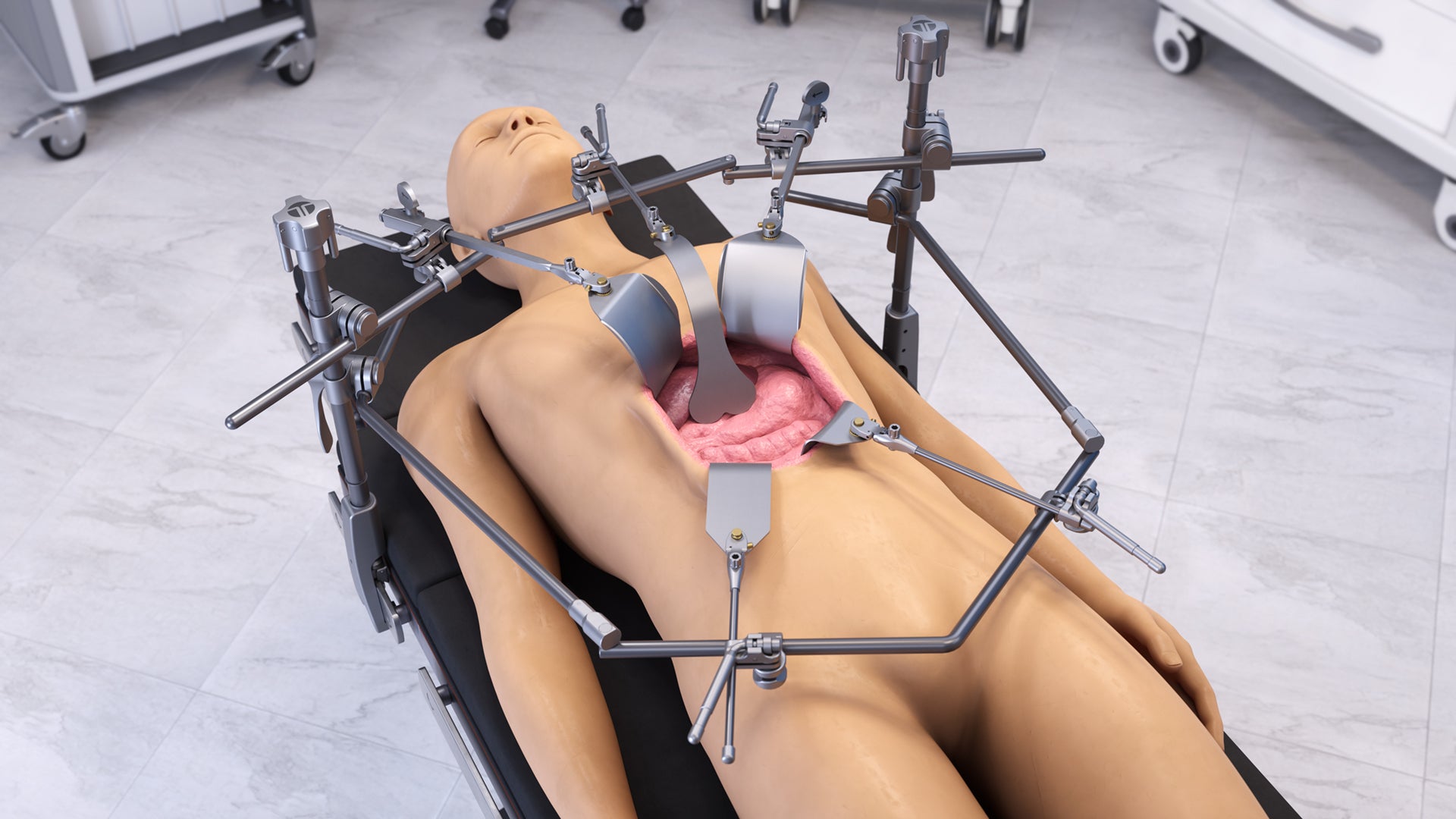 Thompson Surgical product image