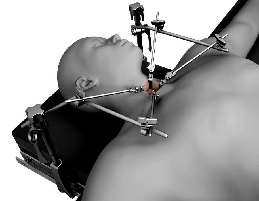 CCA Blade Kit – Thompson Surgical