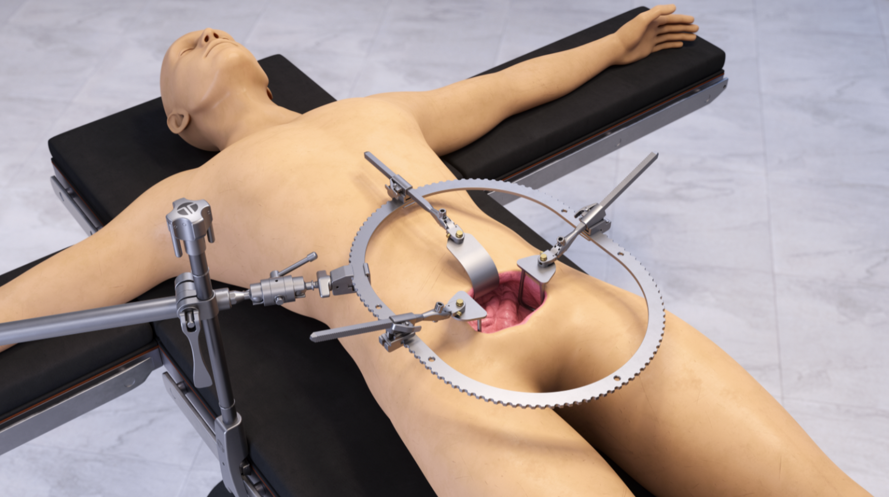 Colon rectal retractor set