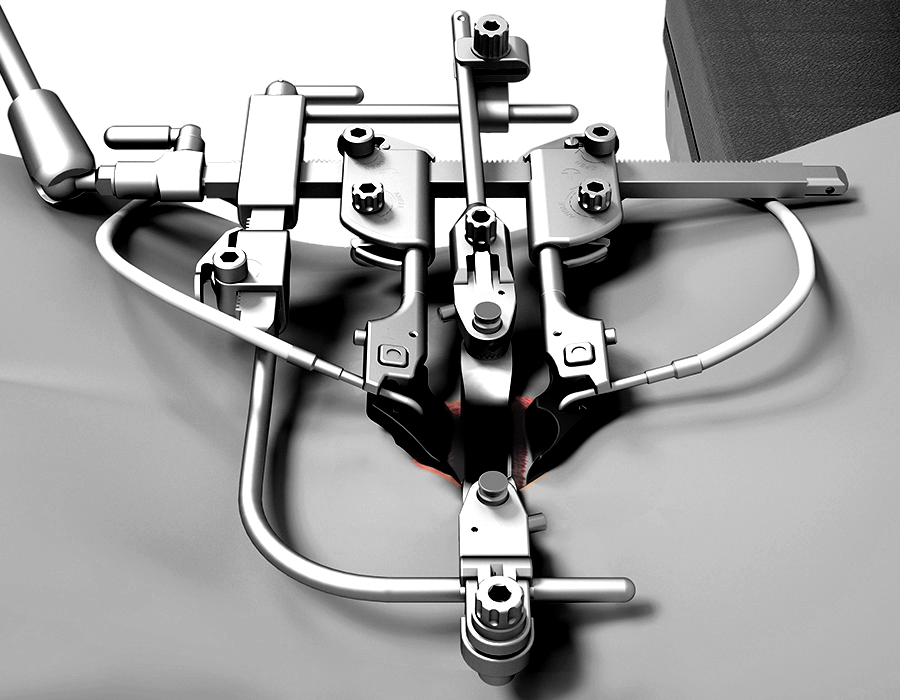 MIS PLA RackFrame Frame Kit