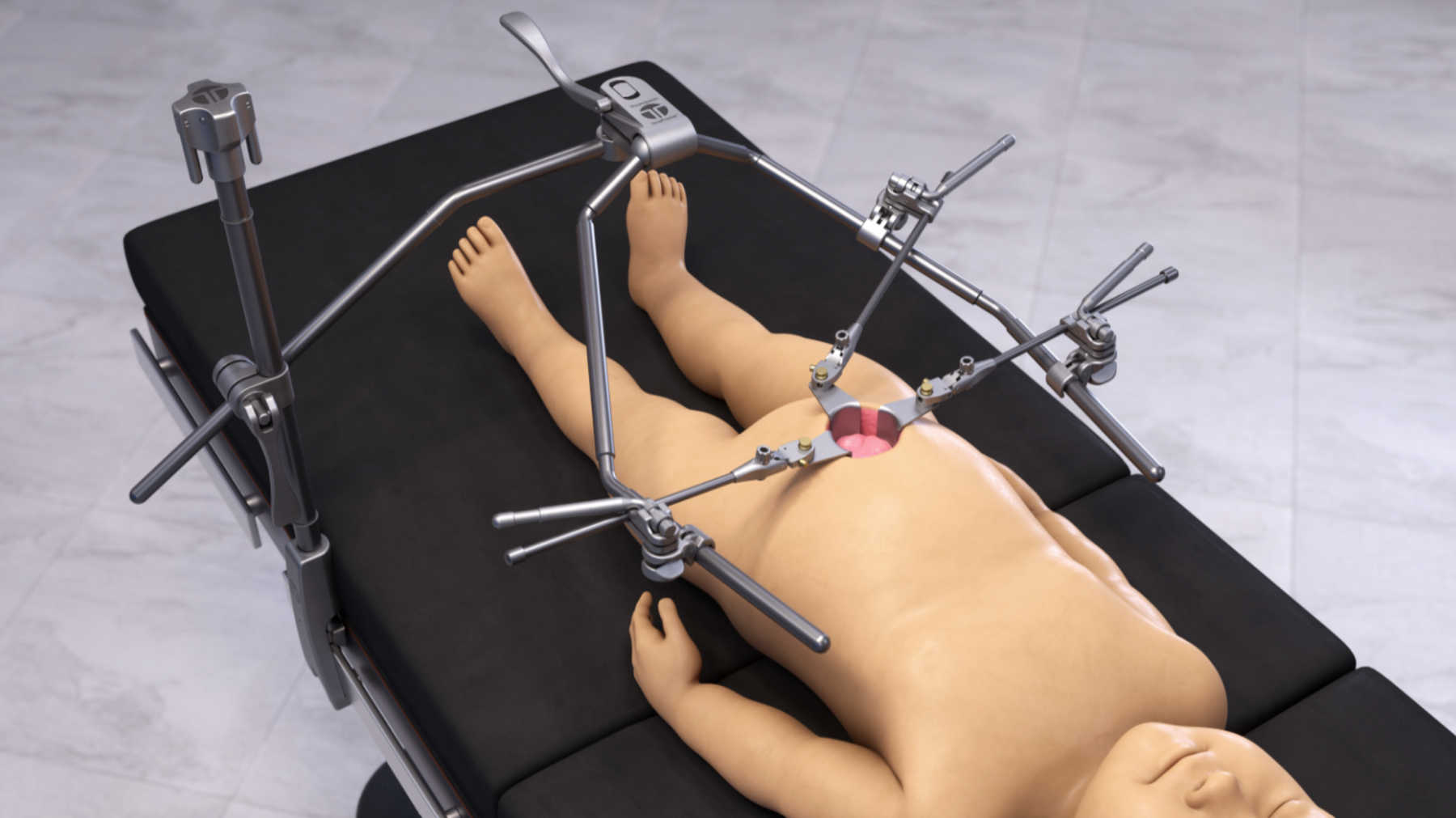 Pediatric retractor set