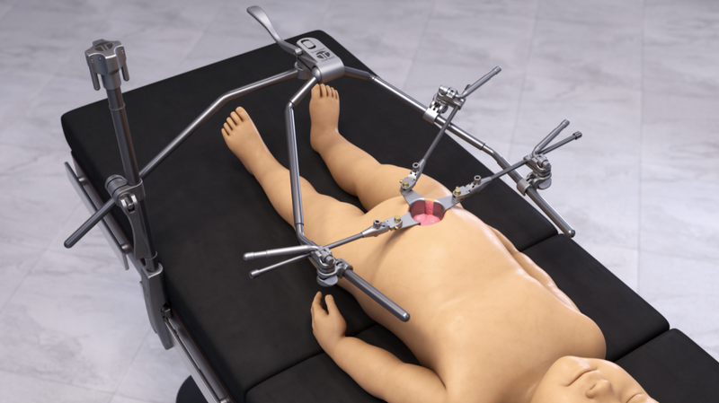 Pediatric retractor set