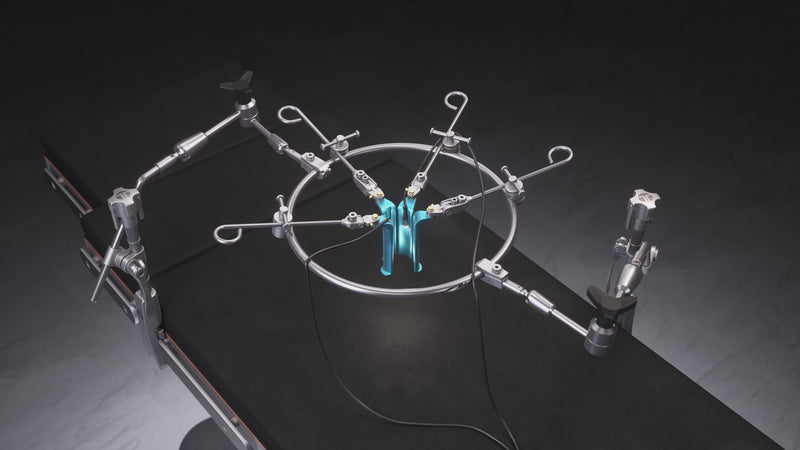 Anterior Lumbar Ring Set Up